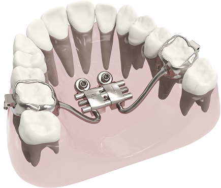 distal
